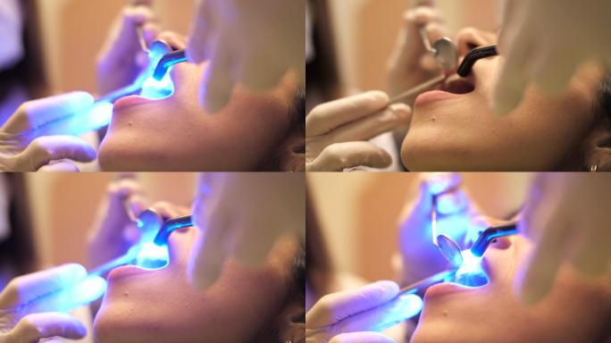 牙医医学疾病拔牙蛀牙健康卫生
