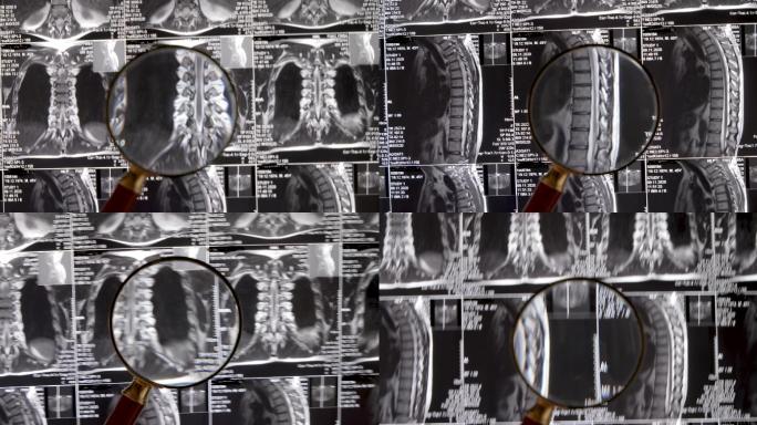 磁共振断层扫描MRI体检核磁共振X射线