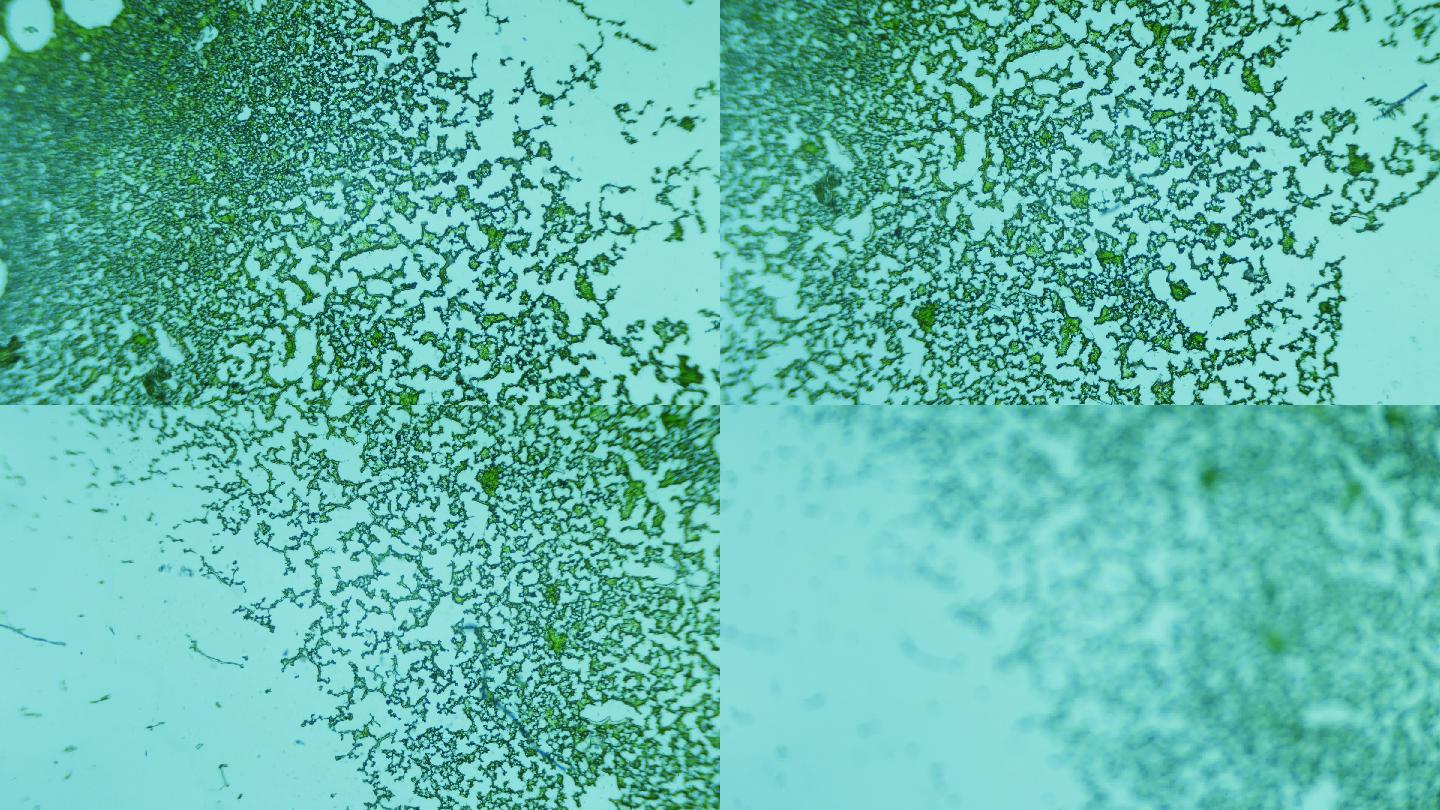 显微镜下的干燥单细胞藻类