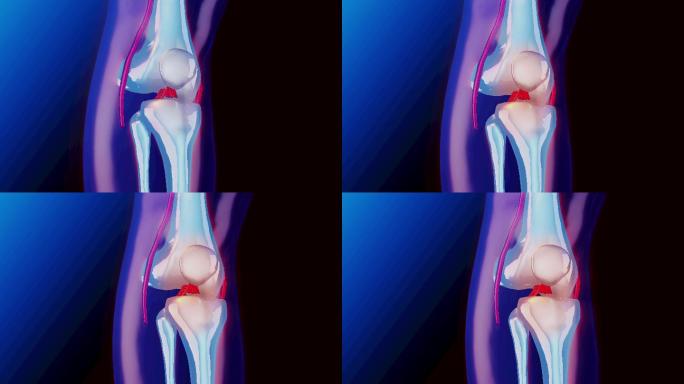 膝盖骨骼x光扫描。解剖三维概念