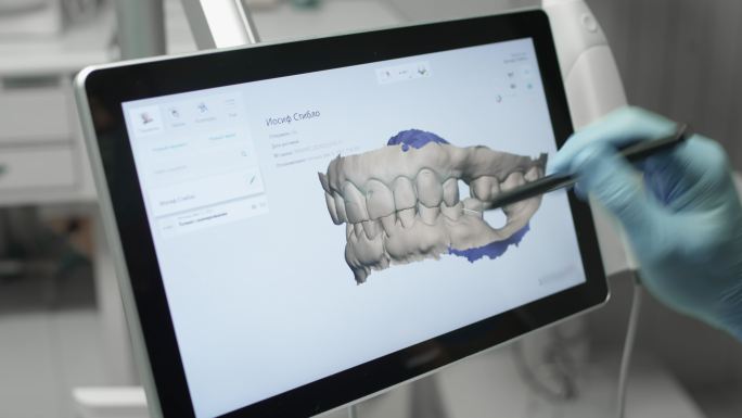 医生检查了下颌的3D模型。