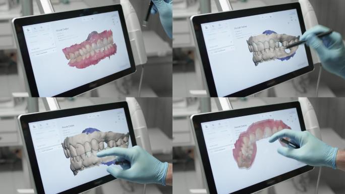 医生检查了下颌的3D模型。