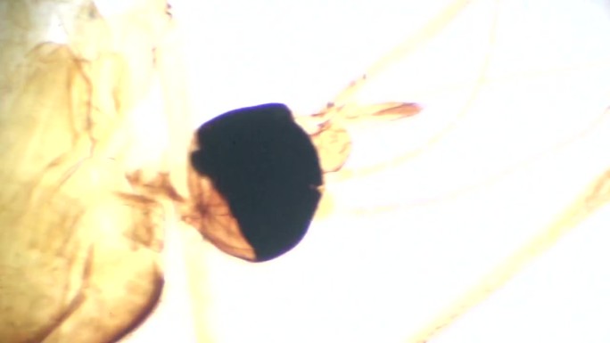 显微镜下的雌性蚊子