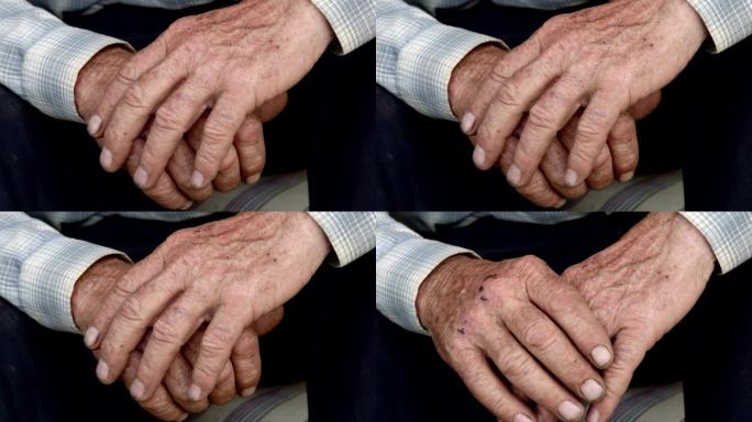 指关节擦伤、黑指甲有缺口的老年男性手