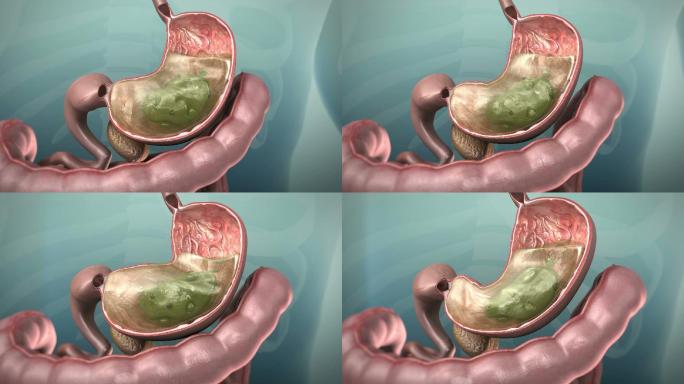 胃肠道的三维动画3D建模素材消化过程胃液