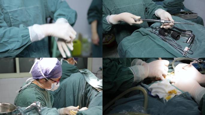 手术，微创手术，术前准备，妇产科医生