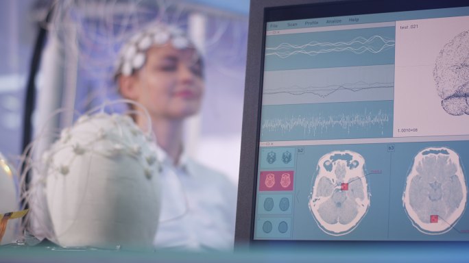 大脑扫描数据外国女人脑部检查