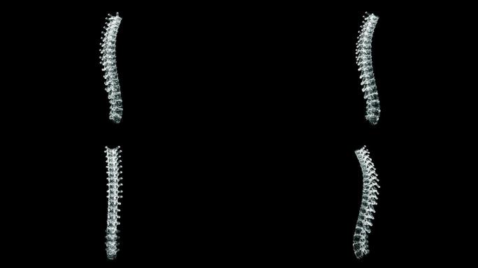 人体脊柱的三维全息图显示