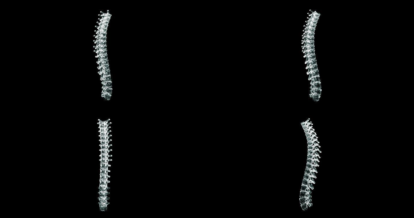 人体脊柱的三维全息图显示