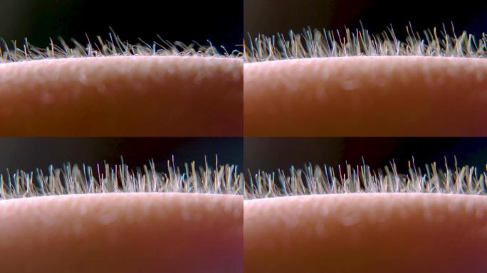 皮肤上的汗毛立起