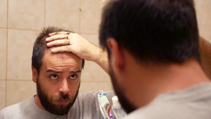 有脱发问题的男人中年掉头发焦虑抑郁