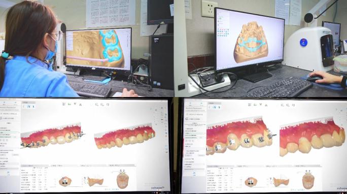 牙科医生建模牙医三维建模牙齿健康