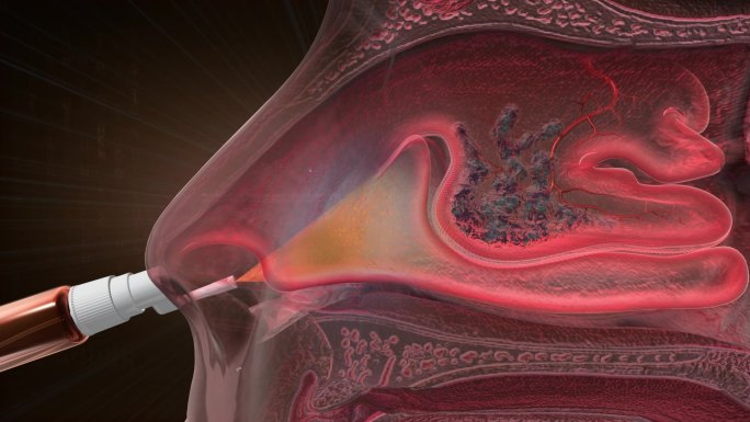 纳米银喷剂穿透鼻粘膜深层病灶，拔掉感染源