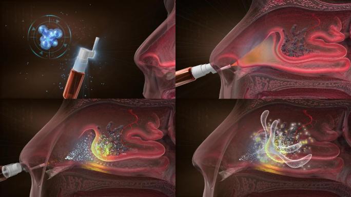 纳米银喷剂穿透鼻粘膜深层病灶，拔掉感染源