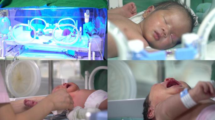 新生儿保温箱NICU蓝光治疗