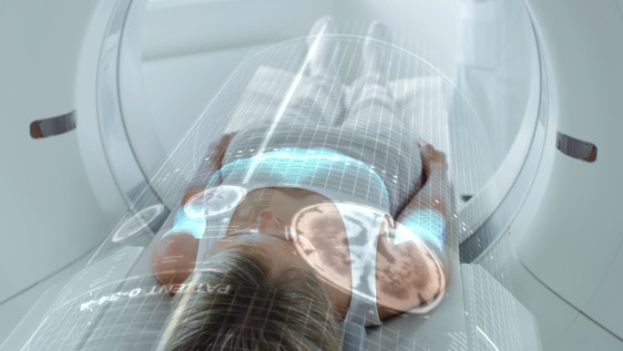 女性患者躺在扫描床上