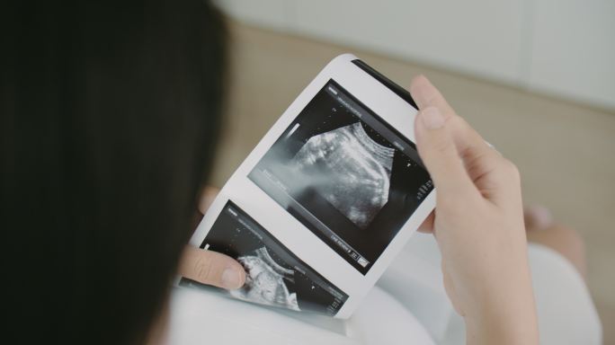 怀孕女性查看3D超声扫描照片