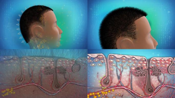 毛发营养胶囊补充微量元素促进毛发快速生长