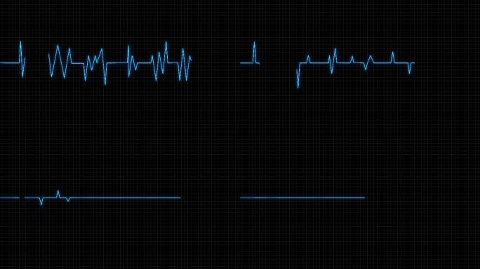 4K心电图跳动停止蓝色