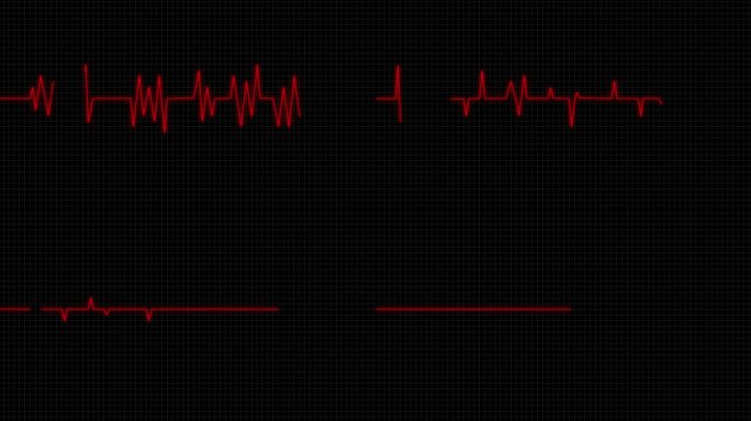 4K心电图跳动停止红色