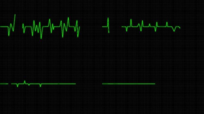 4K心电图跳动停止绿色