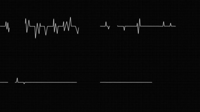 4K心电图跳动停止白色1