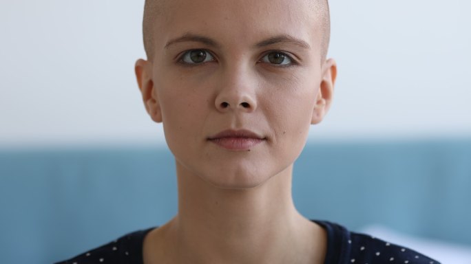 光头美女癌症康复癌症女性女性癌症疾病化疗