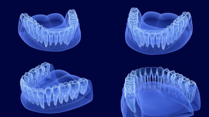 牙科3D动画牙床下颚牙龈