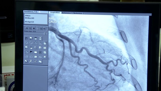 临床医学研究、血管造影