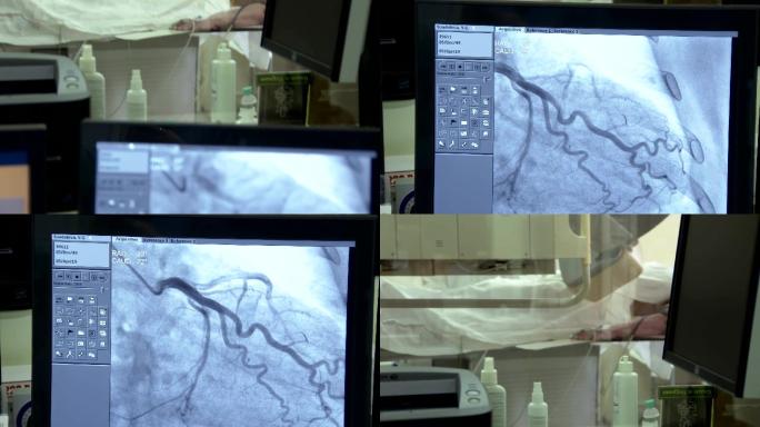 临床医学研究、血管造影