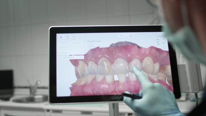 医生检查了下颌的3D模型。