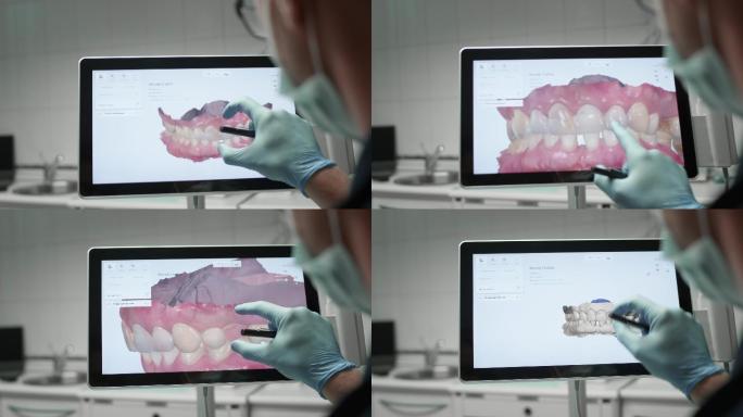 医生检查了下颌的3D模型。