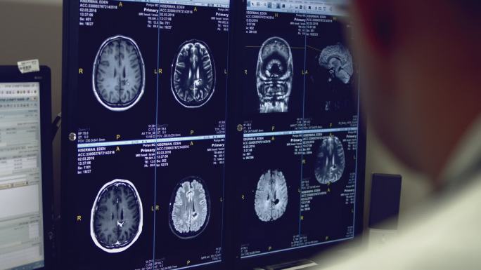 大脑X光片医疗拍片脑部