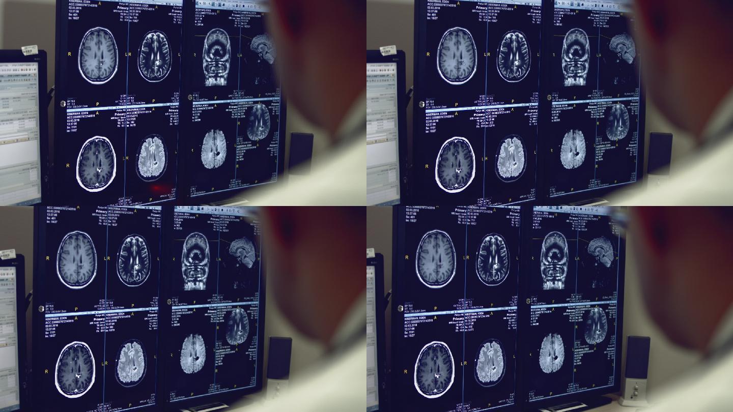 大脑X光片医疗拍片脑部