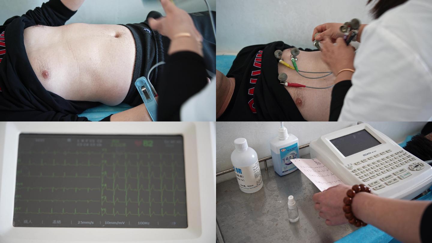 医院手术室医生做心电图抢救病人