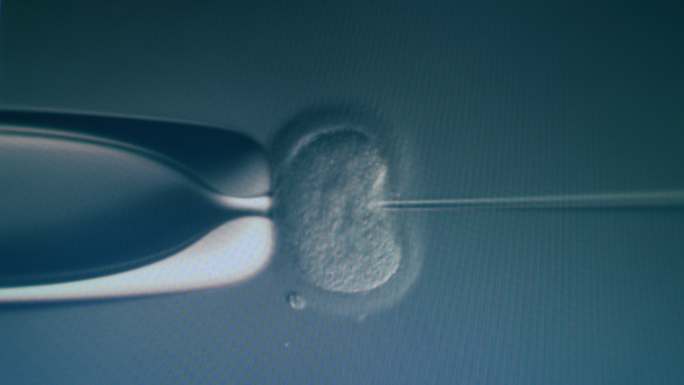 体外受精微观受精卵医疗胎儿三维动画