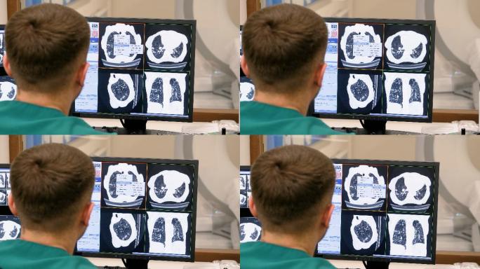 肺部扫描癌症体检恶性肿瘤核磁共振