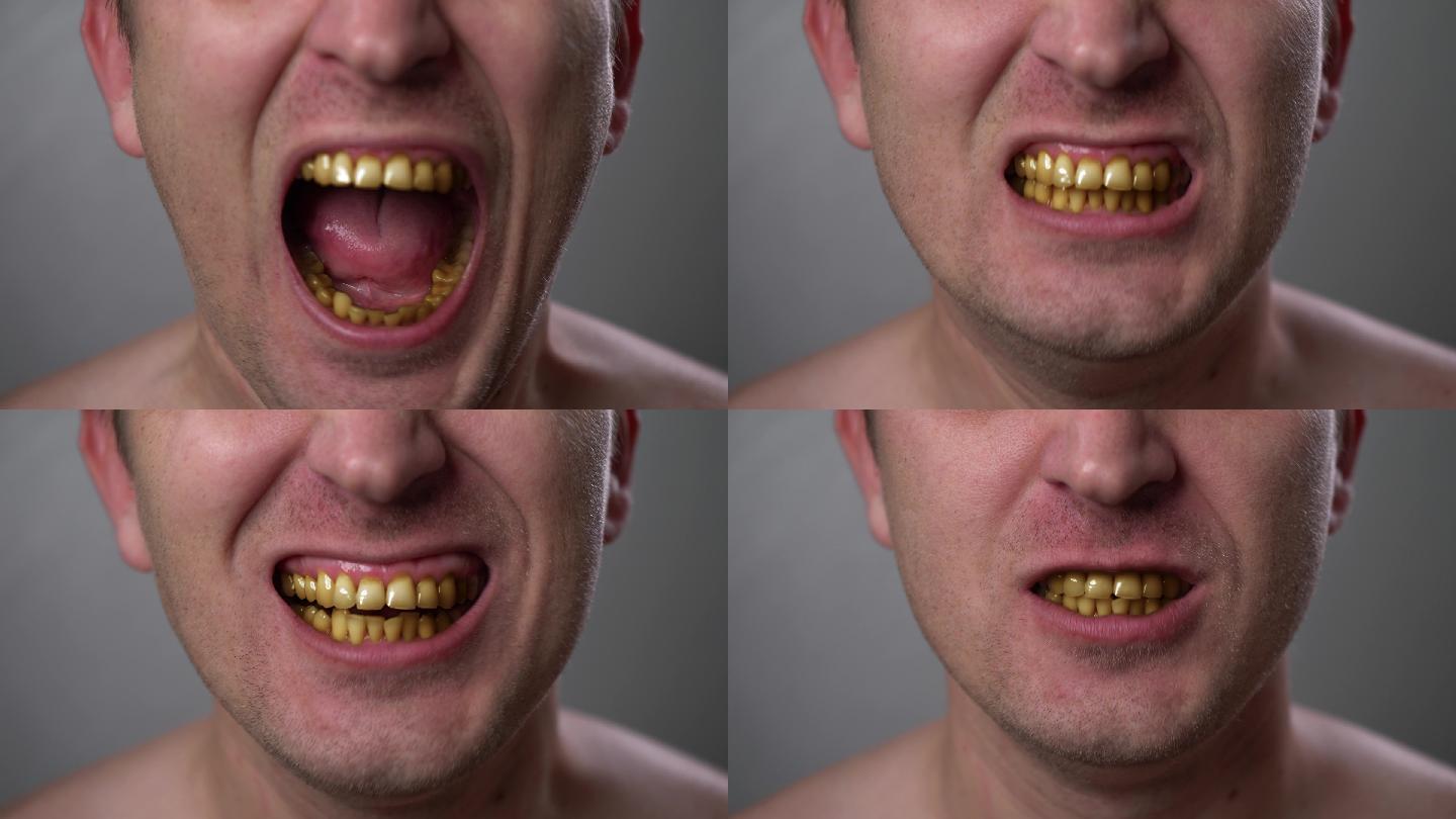 为什么牙齿总是很黄？ - 知乎