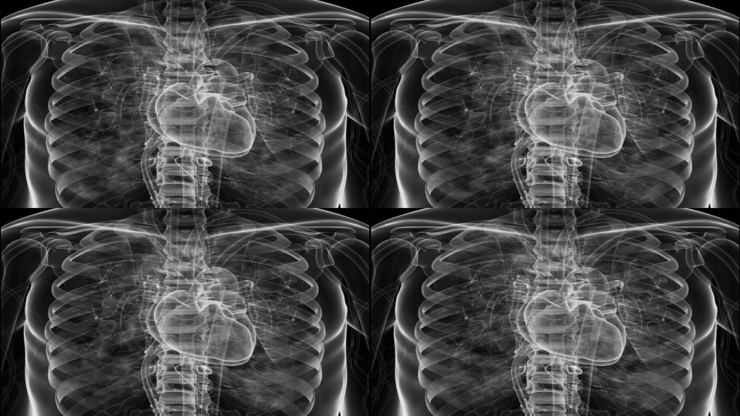 冠状病毒的胸部x光检查