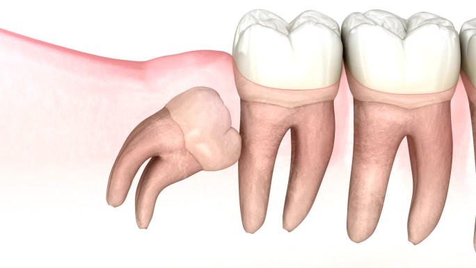 医学上精确的牙齿3D动画