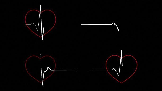 心跳平缓，心脏跳动