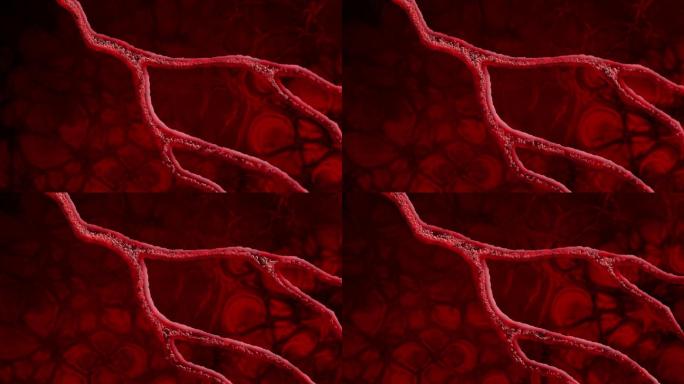 血细胞和静脉心脑血管疏通软化人体循环