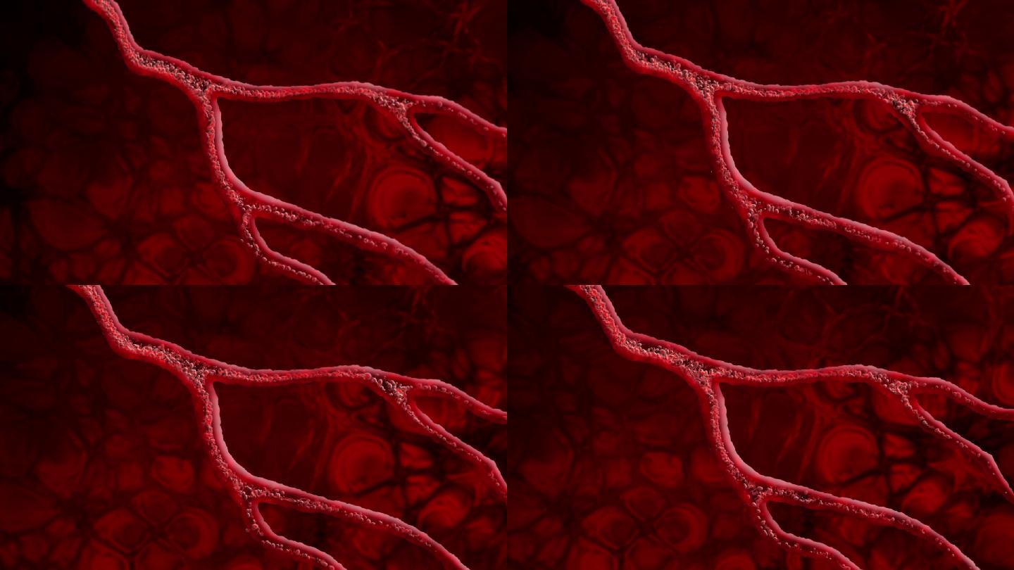 血细胞和静脉心脑血管疏通软化人体循环