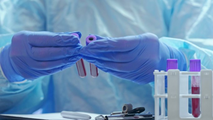 戴手套的护士在实验室研究血样。