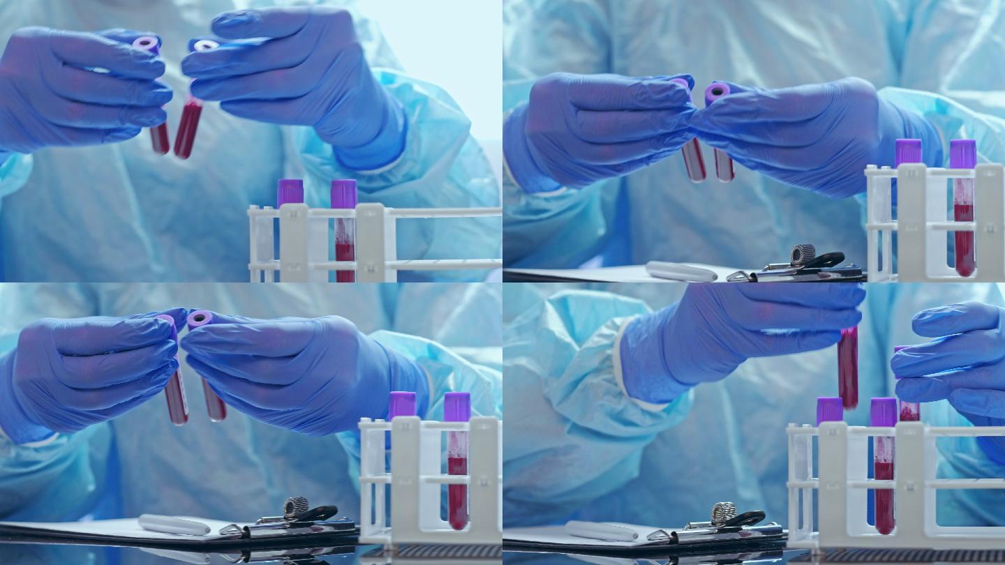 戴手套的护士在实验室研究血样。