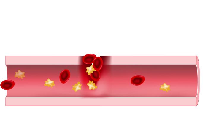 血管中的红细胞和血小板