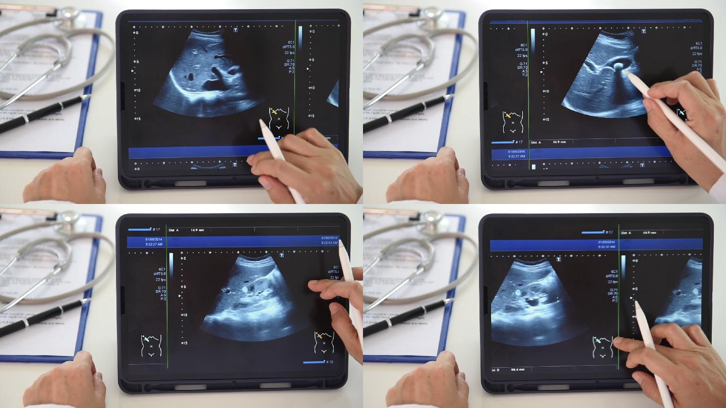 超声波图像诊断查看胎儿分析病情