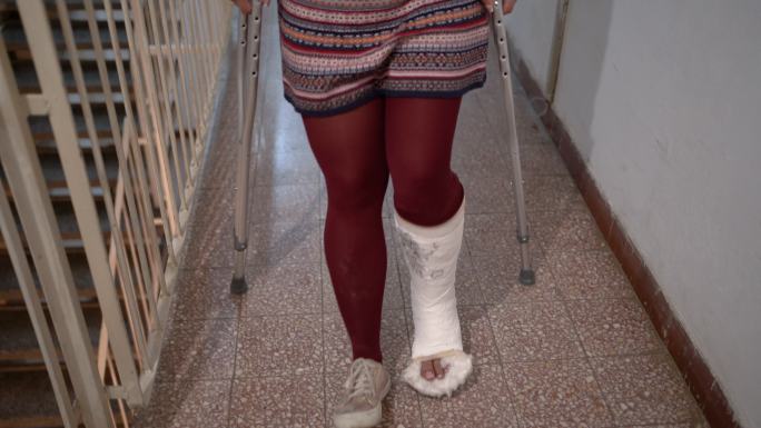 脚部受伤的女人受伤脚打石膏