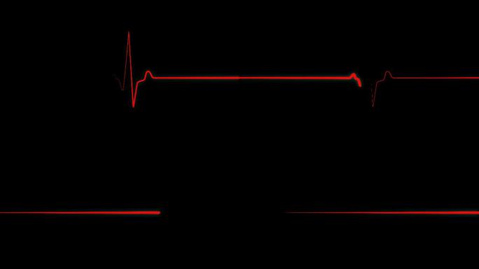 心电图屏幕上的红色心跳线
