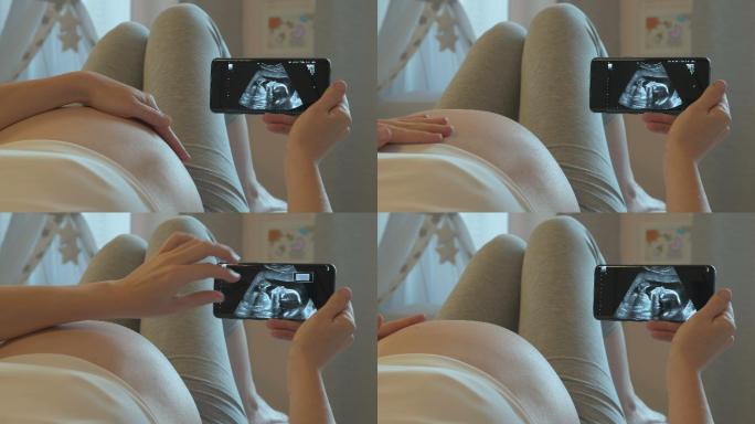 超声波检查孕妇看B超图三维超声图像摸肚子